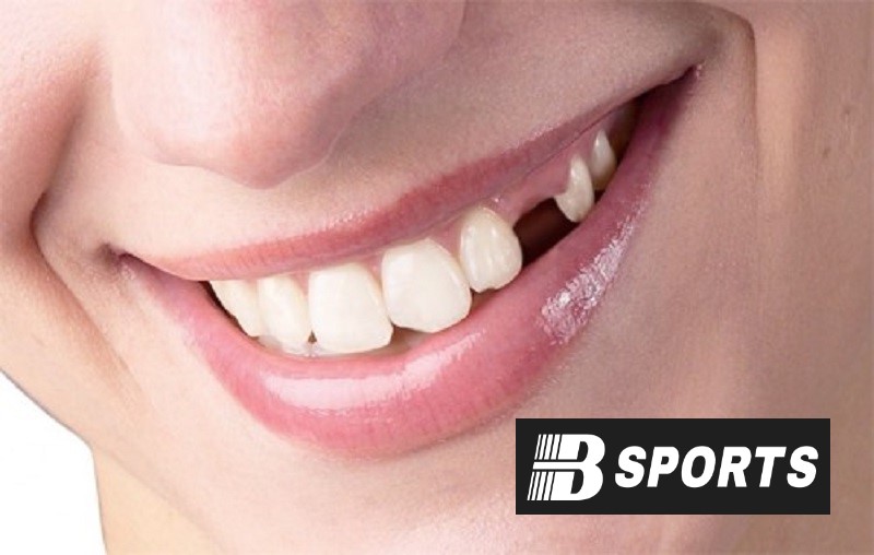 Nằm mơ rụng răng đánh con gì dễ trúng nhất ở Bsports Nằm mơ rụng răng đánh con gì dễ trúng nhất ở Bsports