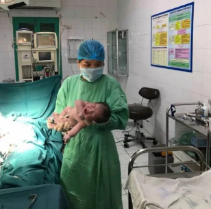 Bé gái hạ sinh thành công Bé gái hạ sinh thành công